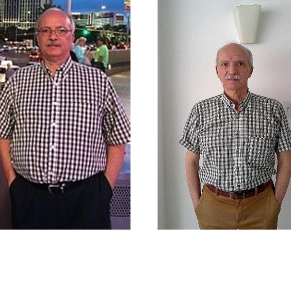 weight loss after 67 before and after photos